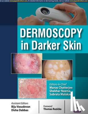 Chatterjee, Manas, Neema, Shekhar, Malakar, Subrata - Dermoscopy in Darker Skin