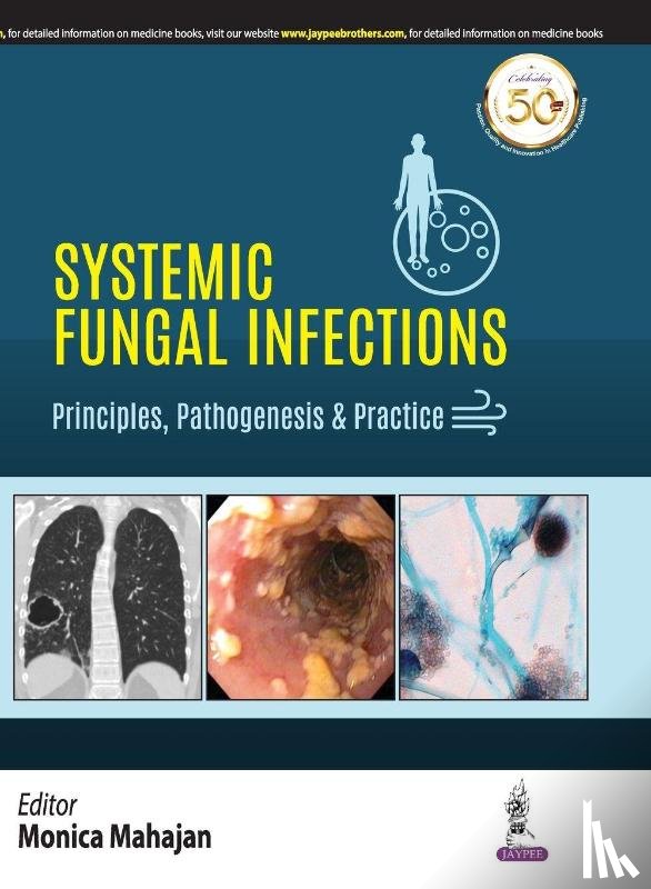 Mahajan, Monica - Systemic Fungal Infections: Principles, Pathogenesis & Practice