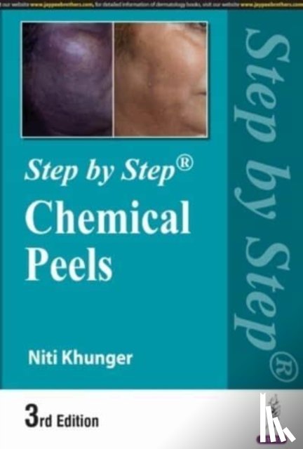Khunger, Niti - Step by Step: Chemical Peels