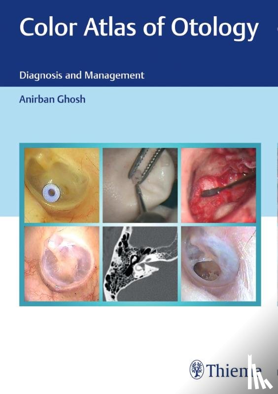 Ghosh, Anirban - Color Atlas of Otology
