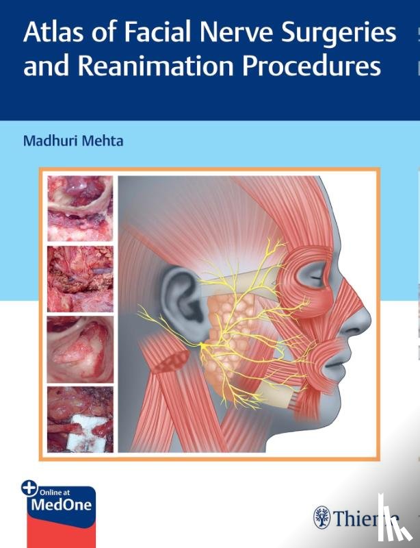  - Atlas of Facial Nerve Surgeries and Reanimation Procedures