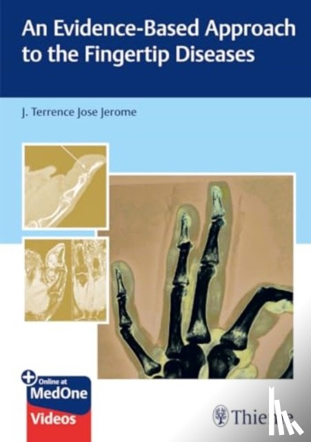 Jerome, J. Terrence - An Evidence-Based Approach to the Fingertip Diseases