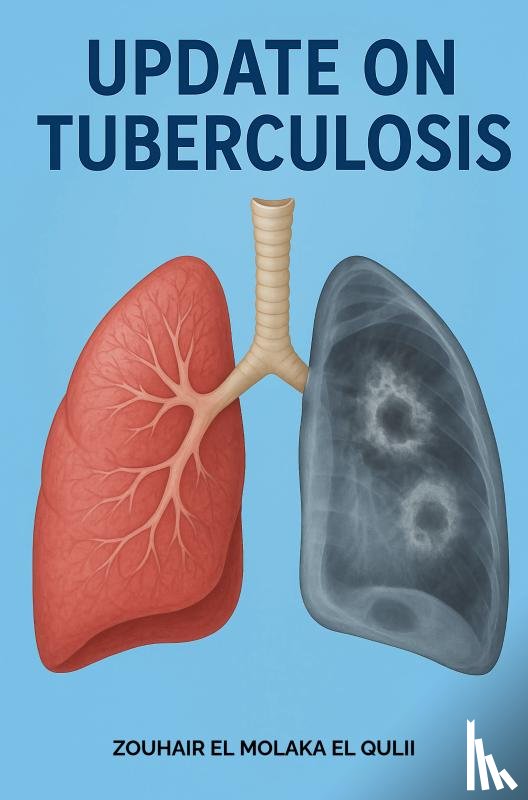 El Molaka El Qulii, Zouhair - Update on tuberculosis