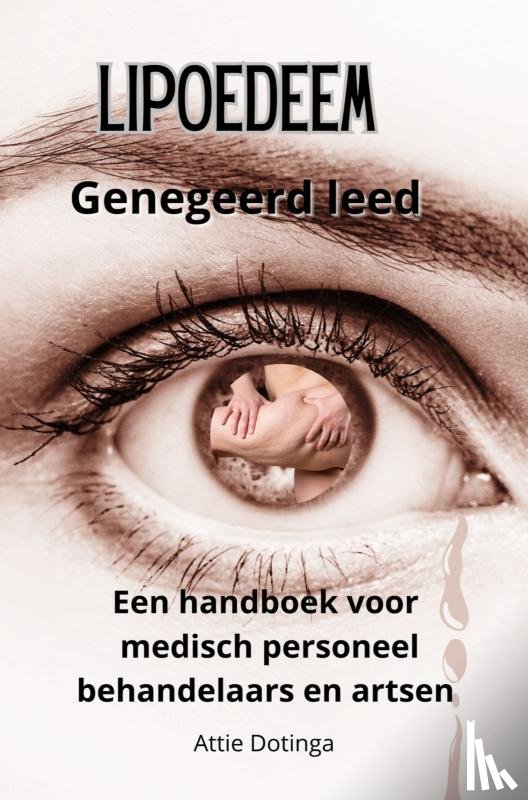 Dotinga, Attie - Lipoedeem