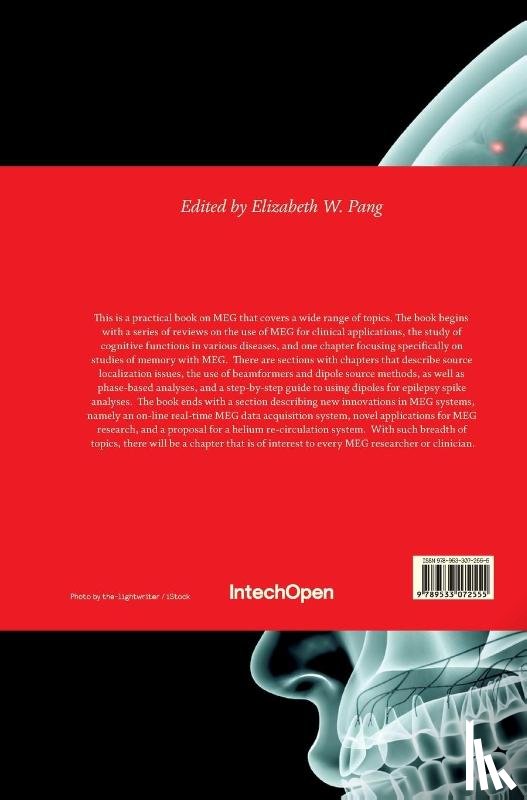  - Magnetoencephalography