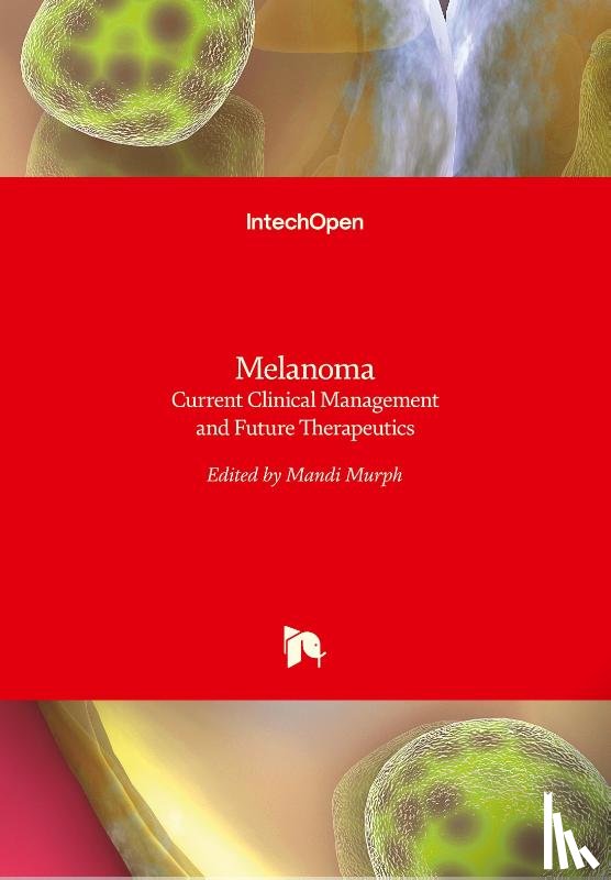  - Melanoma
