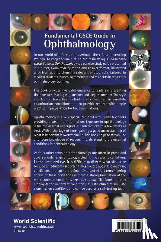 Phua, Val Jun Rong (S'pore National Eye Centre, Ng, Wei Yan (S'pore National Eye Centre, Foo, Li Lian (S'pore National Eye Centre, Wong, Tien Yin (S'pore National Eye Centre - Fundamental Osce Guide In Ophthalmology