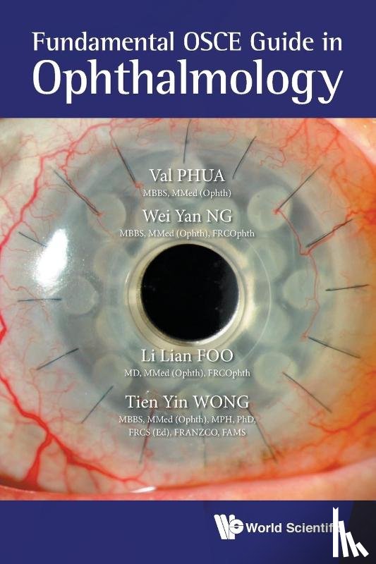Phua, Val Jun Rong (S'pore National Eye Centre, Ng, Wei Yan (S'pore National Eye Centre, Foo, Li Lian (S'pore National Eye Centre, Wong, Tien Yin (S'pore National Eye Centre - Fundamental Osce Guide In Ophthalmology