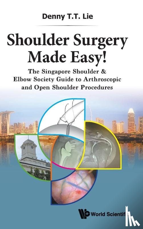 Lie, Denny T T (S'pore General Hospital - Shoulder Surgery Made Easy!: The Singapore Shoulder & Elbow Society Guide To Arthroscopic And Open Shoulder Procedures