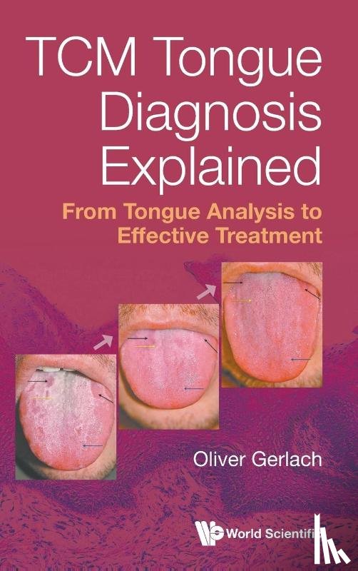 Oliver Gerlach - Gerlach, O: Tcm Tongue Diagnosis Explained: From Tongue Anal