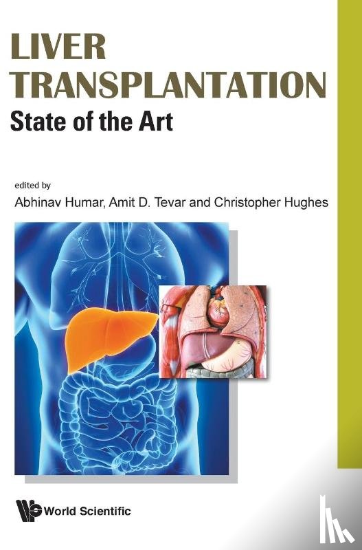  - Liver Transplantation: State Of The Art