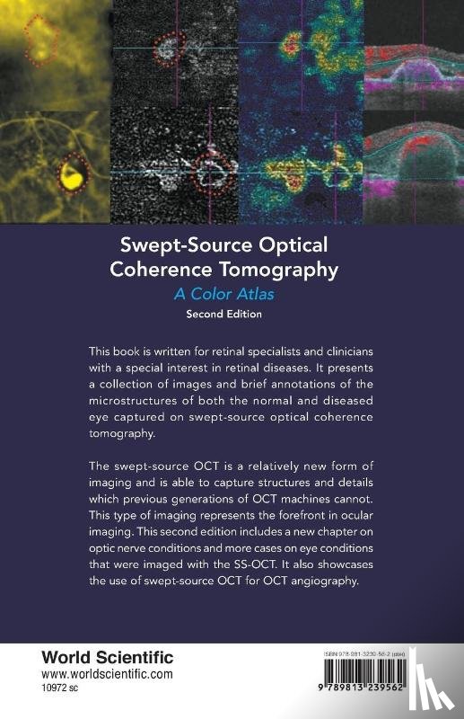 Teo, Kelvin Yi Chong (S'pore National Eye Centre, Wong, Chee Wai (S'pore National Eye Centre, Tsai, Andrew Shih Hsiang (S'pore National Eye Centre, Ting, Daniel Shu Wei (S'pore National Eye Centre - Swept-source Optical Coherence Tomography: A Color Atlas