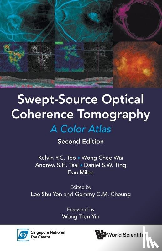 Teo, Kelvin Yi Chong (S'pore National Eye Centre, Wong, Chee Wai (S'pore National Eye Centre, Tsai, Andrew Shih Hsiang (S'pore National Eye Centre, Ting, Daniel Shu Wei (S'pore National Eye Centre - Swept-source Optical Coherence Tomography: A Color Atlas