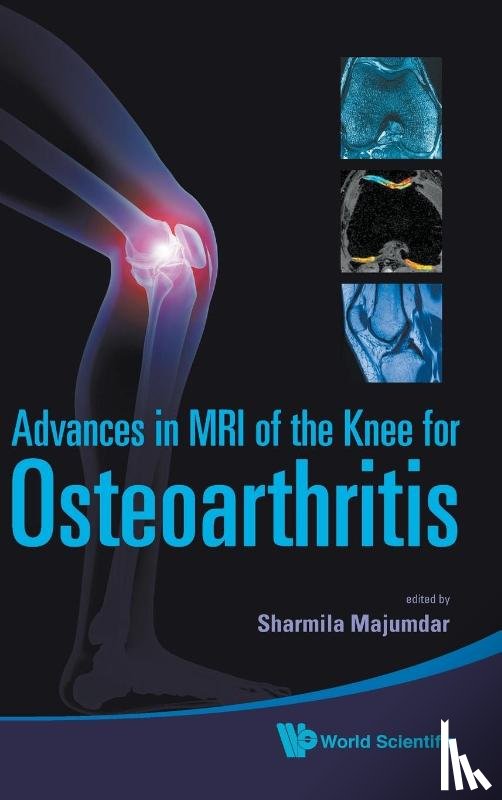  - Advances In Mri Of The Knee For Osteoarthritis