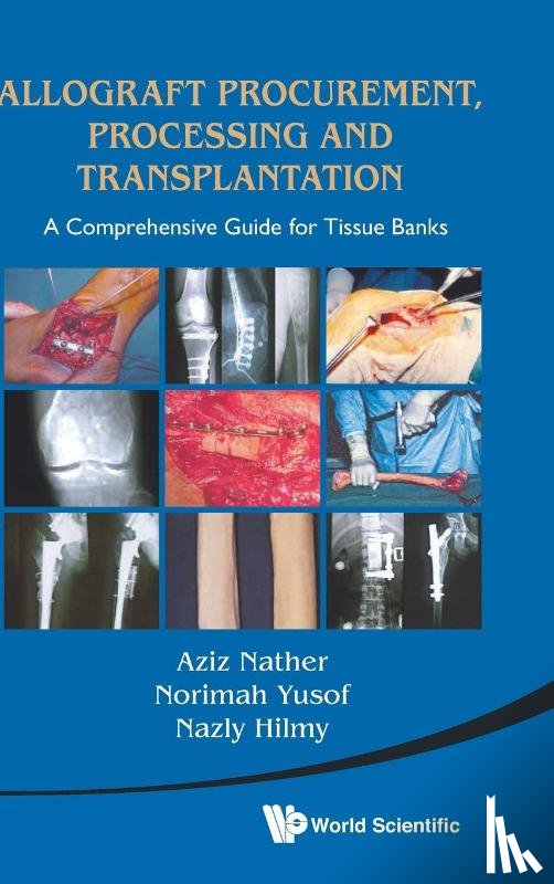  - Allograft Procurement, Processing And Transplantation: A Comprehensive Guide For Tissue Banks