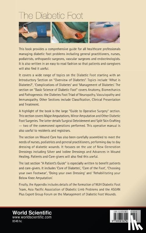  - Diabetic Foot, The