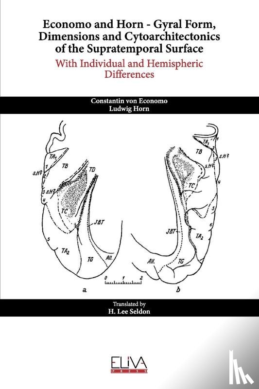 Lee Seldon, H. - Economo and Horn - Gyral Form, Dimensions and Cytoarchitectonics of the Supratemporal Surface
