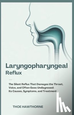 Hawthorne, Theo - Laryngopharyngeal Reflux: The Silent Reflux That Damages the Throat, Voice, and Often Goes Undiagnosed: Its Causes, Symptoms, and Treatment