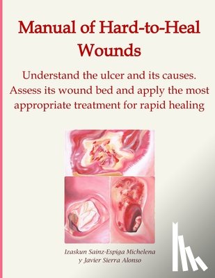 Sierra Alonso, Javier - Manual of Hard-to-Heal Wounds: Understand the ulcer and its causes. Assess its wound bed and implement the most appropriate treatment for rapid healin