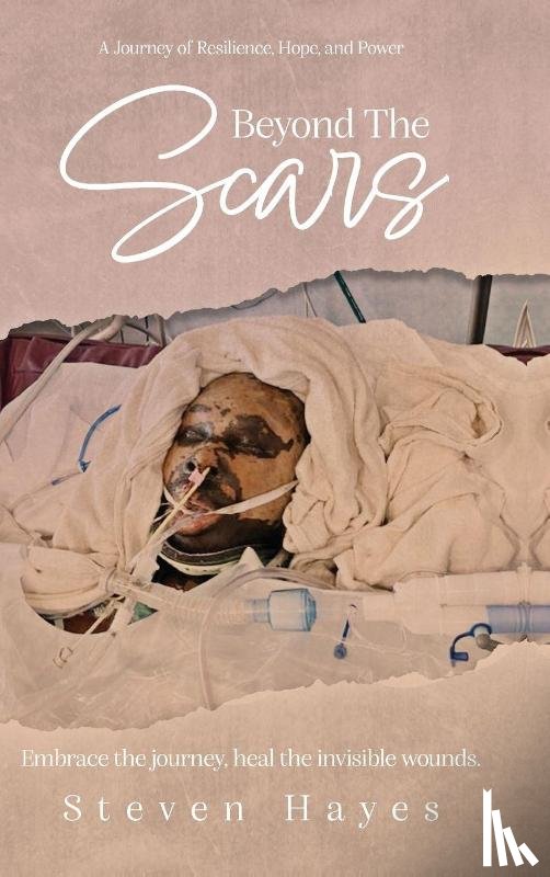Hayes, Steven - Beyond The Scars