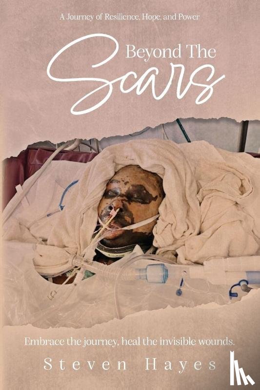 Hayes, Steven - Beyond The Scars