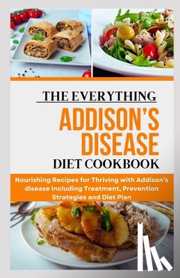 Miller Rd, Joe - The Everything Addison's Disease Diet Cookbook: Nourishing Recipes for Thriving with Addison's disease Including Treatment, Prevention Strategies and
