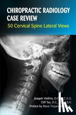 Tao, Cliff - Chiropractic Radiology Case Review: 50 Cervical Spine Lateral Views