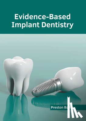 Bailey, Preston - Evidence-Based Implant Dentistry