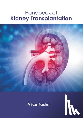 Foster, Alice - Handbook of Kidney Transplantation