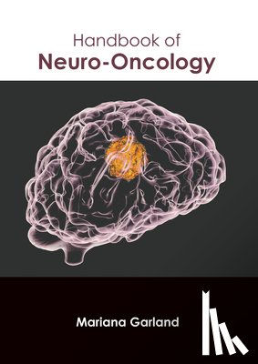 Garland, Mariana - Handbook of Neuro-Oncology