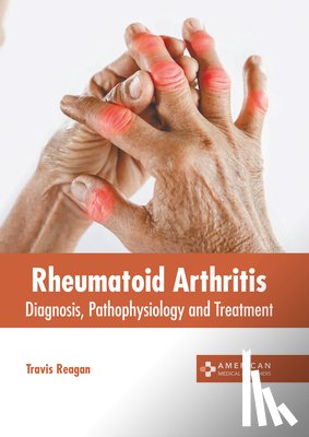 Reagan, Travis - Rheumatoid Arthritis: Diagnosis, Pathophysiology and Treatment