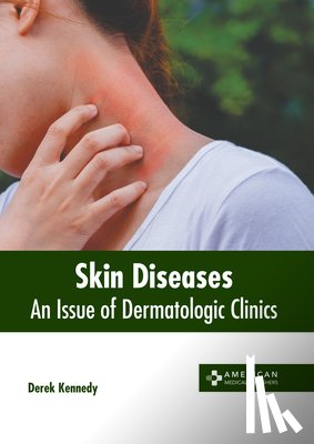 Kennedy, Derek - Skin Diseases: An Issue of Dermatologic Clinics