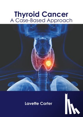 Carter, Lavette - Thyroid Cancer: A Case-Based Approach