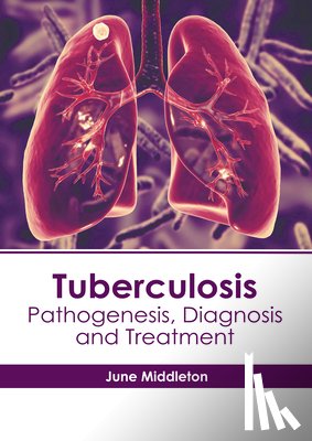 Middleton, June - Tuberculosis: Pathogenesis, Diagnosis and Treatment