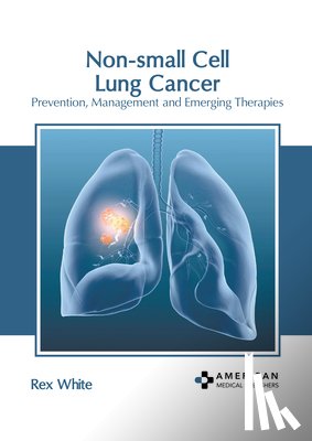 White, Rex - Non-Small Cell Lung Cancer: Prevention, Management and Emerging Therapies
