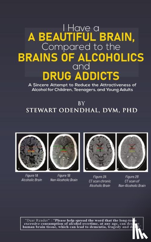 Odendhal, DVM - I Have a Beautiful Brain, Compared to the Brains of Alcoholics and Drug Addicts