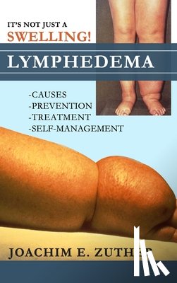 Zuther, Joachim - It's Not Just a Swelling! Lymphedema