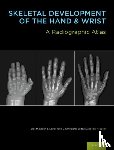 Gaskin, Cree M. (Assistant Professor of Radiology, Kahn, S. Lowell (Interventional Radiologist, Bertozzi, J. Christoper (Clinical Instructor, Bunch, Paul M. (Musculoskeletal Radiology - Skeletal Development of the Hand and Wrist