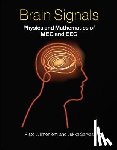 Ilmoniemi, Risto J. (Aalto University School of Science), Sarvas, Jukka (Aalto University School of Science) - Brain Signals