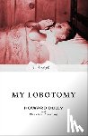 Dully, Howard, Fleming, Charles - MY LOBOTOMY
