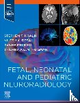 Kralik, Stephen (Department of Radiology, Texas Childrens Hospital, Houston, Texas, USA), Desai, Nilesh (Department of Radiology, Texas Childrens Hospital, Houston, Texas, USA) - Fetal, Neonatal and Pediatric Neuroradiology
