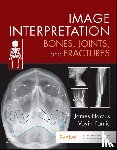 Harcus, James (Lecturer in Diagnostic Imaging, Pantic, Voyin - Image Interpretation: Bones, Joints, and Fractures