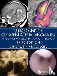 Paladini, Dario (Gaslini Children’s Hospital, Volpe, Paolo - Ultrasound of Congenital Fetal Anomalies