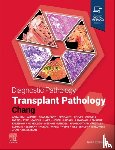 Chang, Anthony, MD (Director, UChicago Medical Laboratories, Director, Renal Pathology and Renal Pathology Fellowship, Associate Director, Pathology Residency Program, University of Chicago, Chicago, Illinois) - Diagnostic Pathology: Transplant Pathology