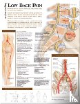 Anatomical Chart Company - Understanding Low Back Pain Anatomical Chart