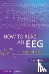 Jadeja, Neville M. (UMass Chan Medical School) - How to Read an EEG