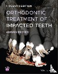 Becker, Adrian (Department of Orthodontics at the Hebrew University-Hadassah School of Dental Medicine - Orthodontic Treatment of Impacted Teeth