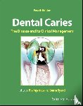  - Dental Caries