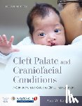 Kummer, Ann W. - Cleft Palate and Craniofacial Conditions: a Comprehensive Guide to Clinical Management