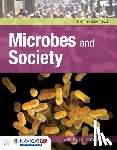 Pommerville, Jeffrey C. - Microbes and Society